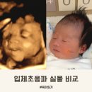 입체초음파 실물 비교 ai 어플 베이비매직 후기