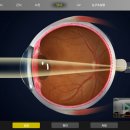 등대지기안경 이미지