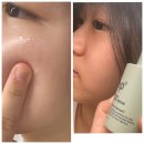 늘어진 모공 탄력 있게 좁히기, 모공 고민 한 번에 타파! SNP 클린포어 타이트닝 세럼 내돈내산 솔직 후기
