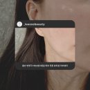 인셀덤소유 | 울산 피부관리 리쏘뷰티에서 피코토닝받았어요~