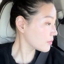 화서동물병원 | 수원역피부과 울트라레이저 2주차 리얼후기 진심너무좋아여