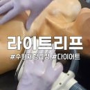 망포역 피부관리 체형교정 라이트리프 수원영통점 바른다이어트 후기