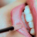 메이트치과의원 | 내 치아, 개운함이 필요해! 대전 치과 스케일링 받고 온 후기요