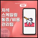 55서하플란트치과의원 | 용인 마북동 스케일링 후 식사 요령과 비용 및 치료 통증 주기 시간 정리