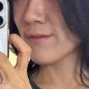 큰전수산 | 스컬트라 6회차 한달 후기ㅣ땅콩형 탈출! 원장님 전수 '부작용 방지 3분 마사지법'