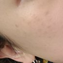 장미꽃과 나이팅게일 피부과의원 이미지