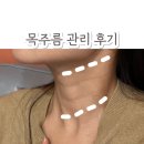 (주)타고타 | 분당피부관리 / 선천성 목주름 관리 케어 리얼 변화 후기 - 리지에스테틱