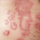 바로스탑한의원 이미지