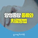 양성종양 종류와 치료방법