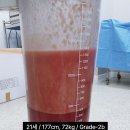 프라우드비뇨기과의원 | 남성 여유증수술 가격 수술 후 운동 정보 알아보기