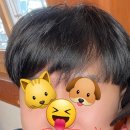 피부과 유목민의 남자 수염 제모 후기 + 서울 피부과 추천