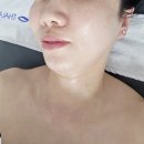 정원온누리약국 | 호계동피부관리 안양피부 맛집 소울래쉬스킨✨ 줄기세포 앰플케어 만족스런 후기