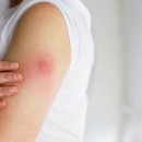 이병철한의원 이미지