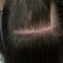 벨르뮤SMP신중동점 | 부평두피문신 자연스러운 효과로 자신감 UP 벨르뮤 신중동점