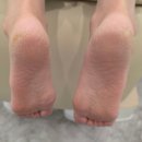 세븐일레븐 평내리치플러스점 | [남양주 발각질 관리] 평내 슈블리 왁싱 / 발각질, 굳은살 관리 대만족 후기