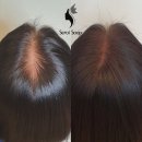 새로이숲부평 이미지