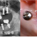 골마천 이미지