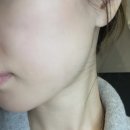 비플랫