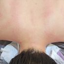 구리목 | 구리미사랑 에스테틱 [바디] 목/승모근 관리 찐후기