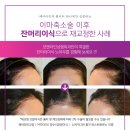 모앤라인성형외과의원 네이버블로그