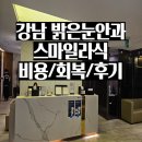 (주)스마일카관리서비스 | 강남 밝은눈안과 스마일라식 비용, 회복, 후기 총정리｜1년 반 경과 내돈내산 리포트