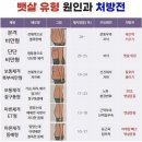 경근도수- 허리 문제 아니었어?? 이미지