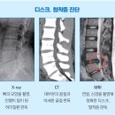 허리통증, 디스크와 협착증은 어떻게 다른가요? 이미지