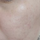 오샤레라이프 | LED 마스크 구입 및 사용기 (feat. 오샤레라이프)