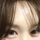 채피부과의원 | 수원인계동 피부과 방황끝!세모아의원 이마보톡스 10일후기