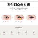 예스성형외과의원 이미지