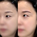 수정샵구월동 | 구월동눈썹문신 유목민 정착한 리메이드송도점 후기