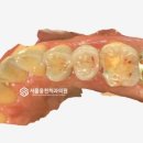 전남치과기공소 이미지