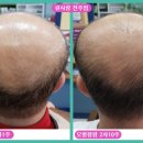 큐사랑호남지사전주점 | [공지] 큐사랑 호남지사 전주점 탈모관리 천연미네랄기능성염색
