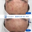 누보드스킨