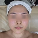 풀282 | [경남/창원] 282에스테틱 | Full-Up 풀페이스 리프팅 울쎄라 솔직 후기 전후비교