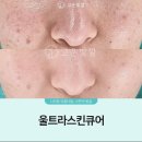 고운스킨케어 이미지