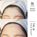 제이비라인 이미지