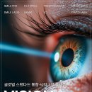 스마일 | 스마일라식후기 꼭 확인해야 할 비전가이드 정보 정리