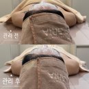 역곡남부역(12137) | 역곡역 피부관리 그리아에스테틱 아프지않은 윤곽재생관리 후기