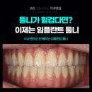 정치과기공소 | 동래임플란트틀니 고민 끝? 식사 편하고 안 빠지는 이유