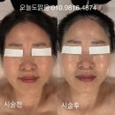 피부맑음 에스테틱 | 포천 송우리 피부관리 후기 좋은 곳 맑음 에스테틱