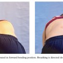 Schroth Method for Scoliosis : Note 이미지