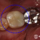 선명치과기공소 이미지
