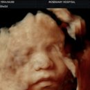 보성군 장애인 직업재활센터 | 중 질염 |불면증 | 입체초음파 | 대구 로즈마리 병원 문화센터 | 대구산전필라테스 | 대구 임산부(2026.03)