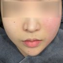 더올의원 | 수원 올타이트리프팅 ㅎㅍ의원 키닥터 후기 효과 가격공유 총정리 내돈내산
