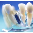 고려치과기공소 이미지