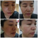 (주)젬나컴퍼니 | 올리브영추천제품/더마에어톡스 탄산팩 사용후기