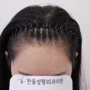 한올성형외과의원 이미지