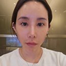[더록시에스테틱청담점/강남피부관리 에스테틱] 얼굴 트러블 강필 받고 온 솔직 후기🫧 @더록시 청담점