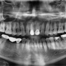 연세내일치과의원 이미지
